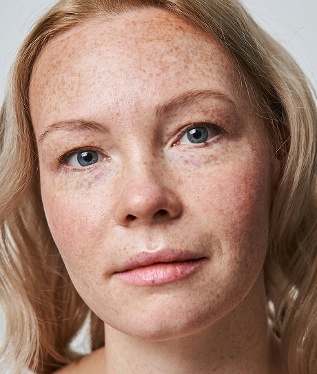 Close-up of a person with freckles and blonde hair.