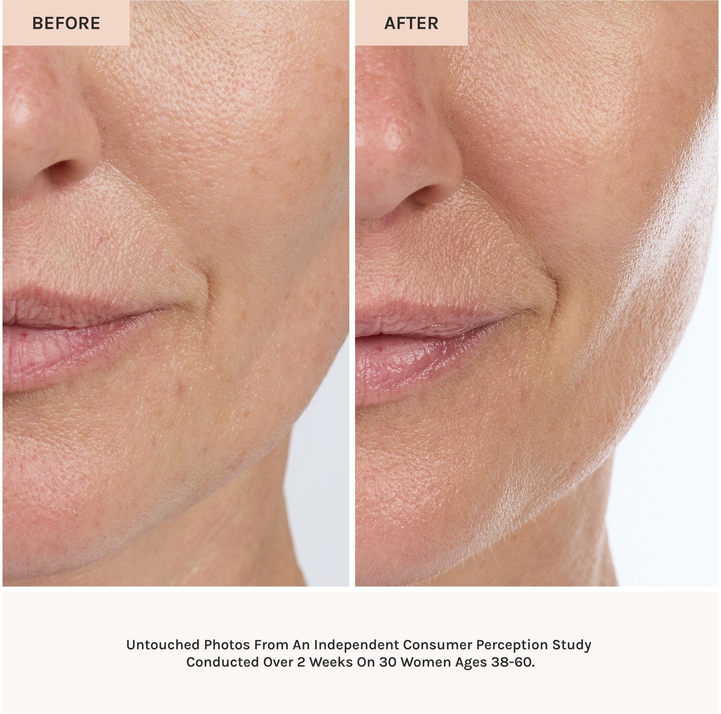Before and after comparison of a woman's face with skincare treatment, showing smooth skin.