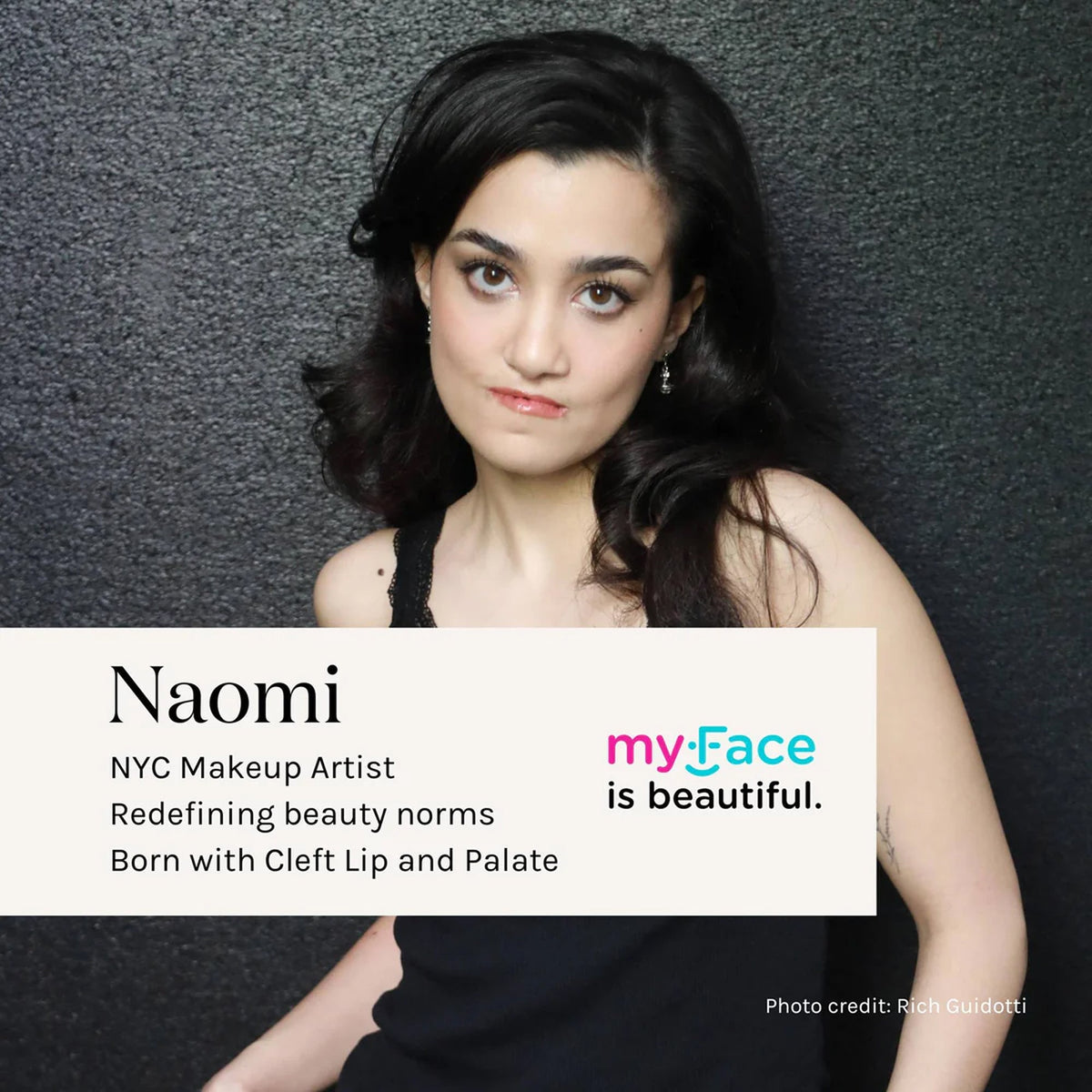 myFace personal story