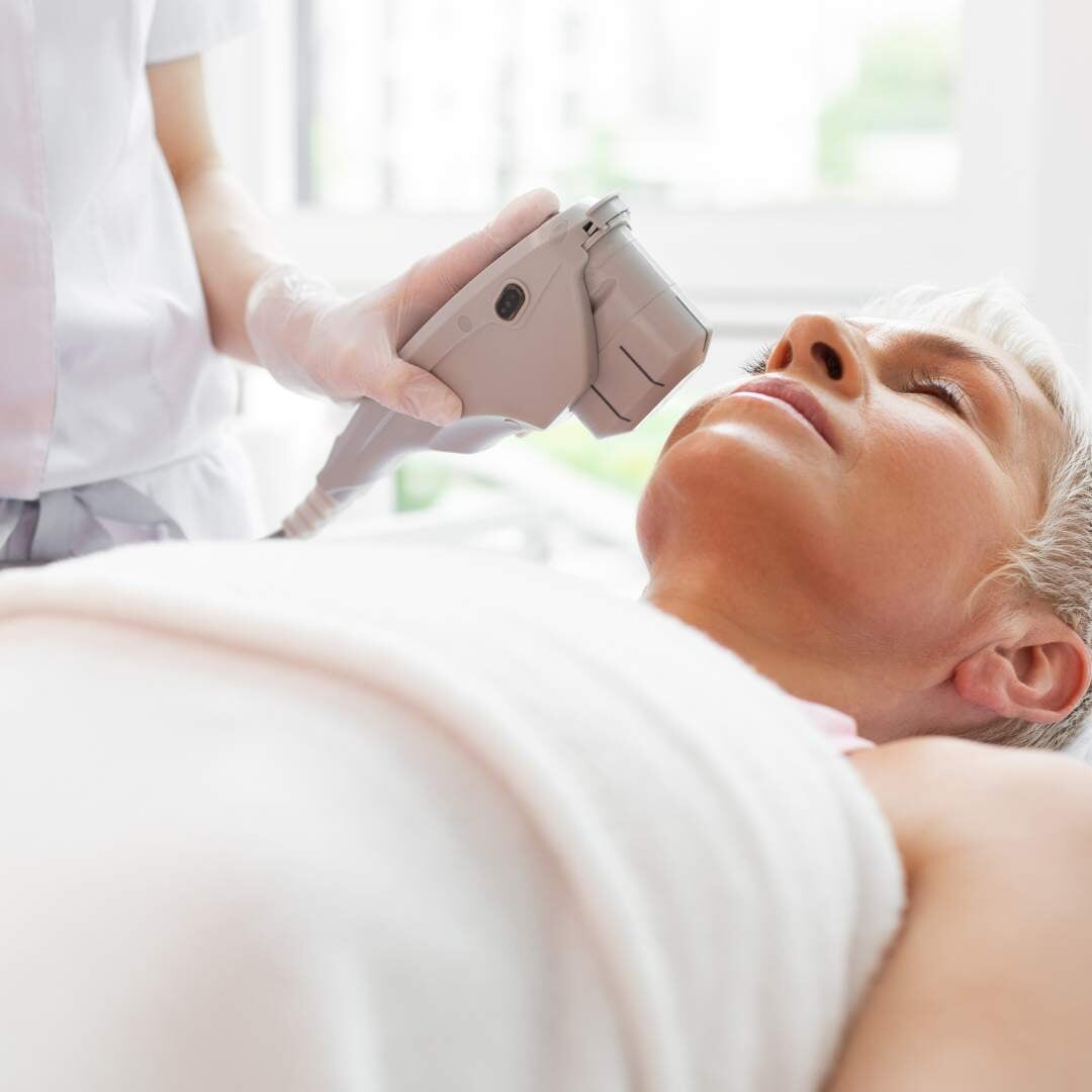 lady getting IPL treatment