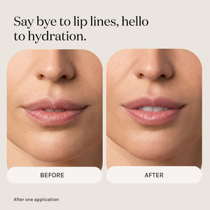 Say bye to lip lines, hello to hydration. Image of before and after