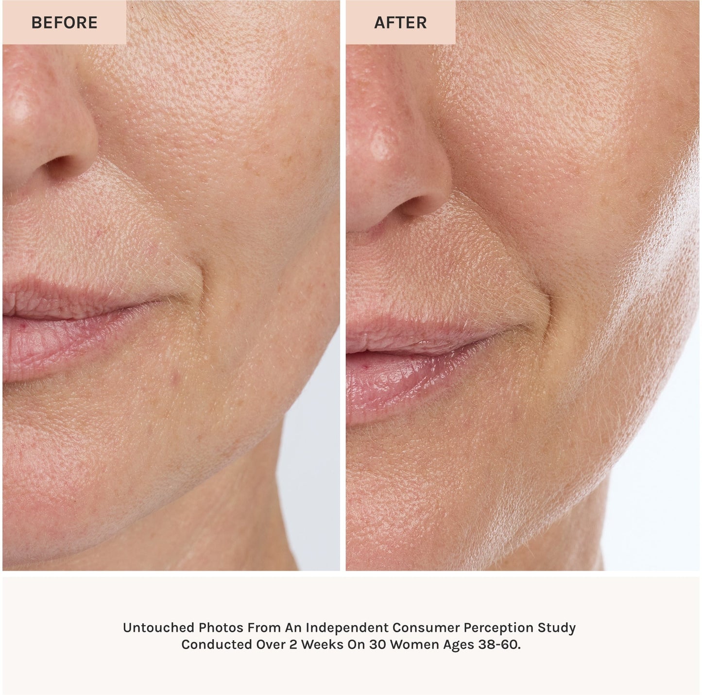Before and after comparison of a woman's face showing skin improvement.