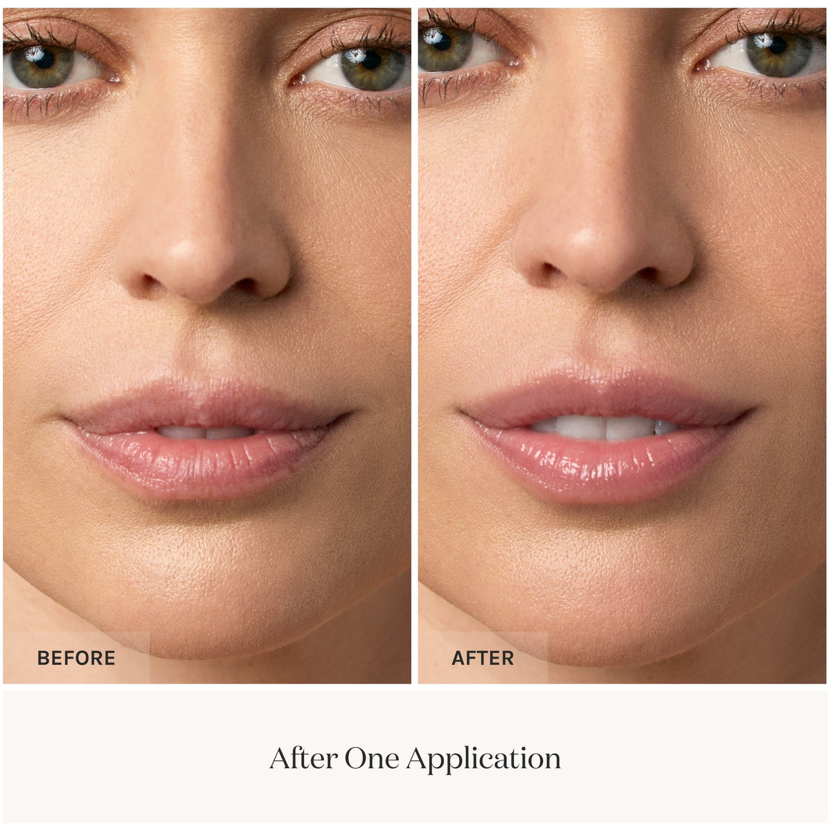Lip Whip Peptide smoothing before and after